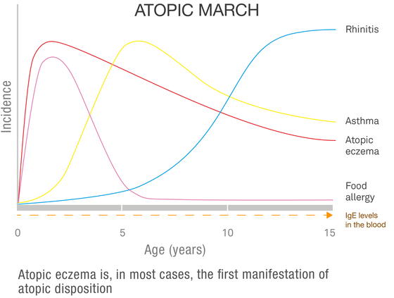 Atopic march