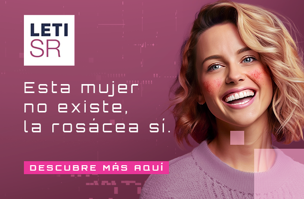 Banner rosacea ES mobile