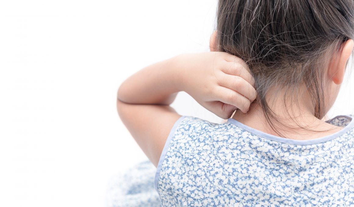 Niño con piel enrojecida debido a dermatitis atópica infantil
