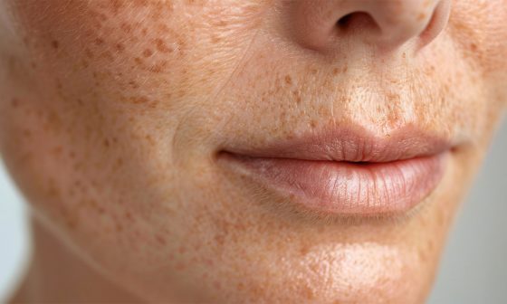 Cuidado de los labios y la nariz en pieles sensibles