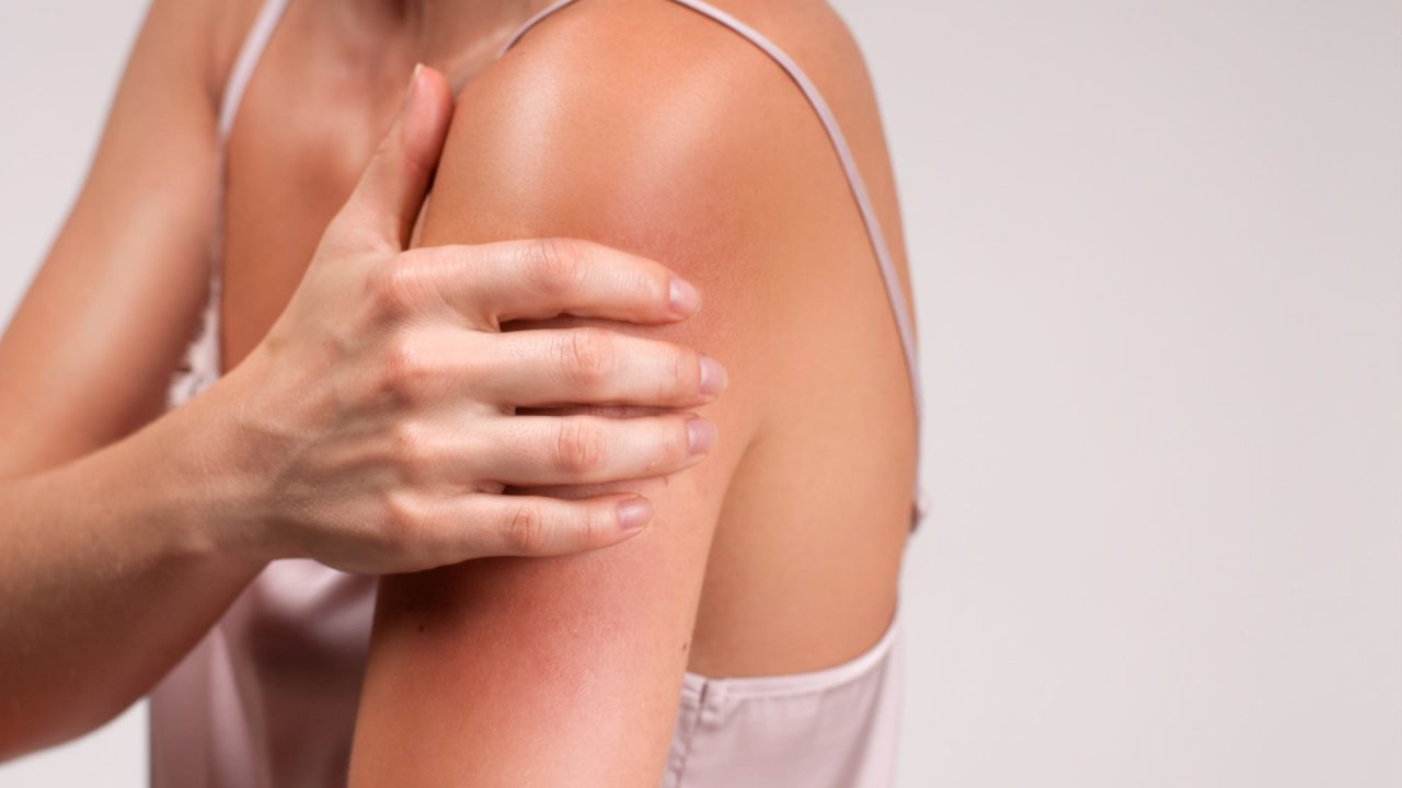 prevenir irritación piel