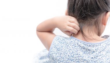 Niño con piel enrojecida debido a dermatitis atópica infantil