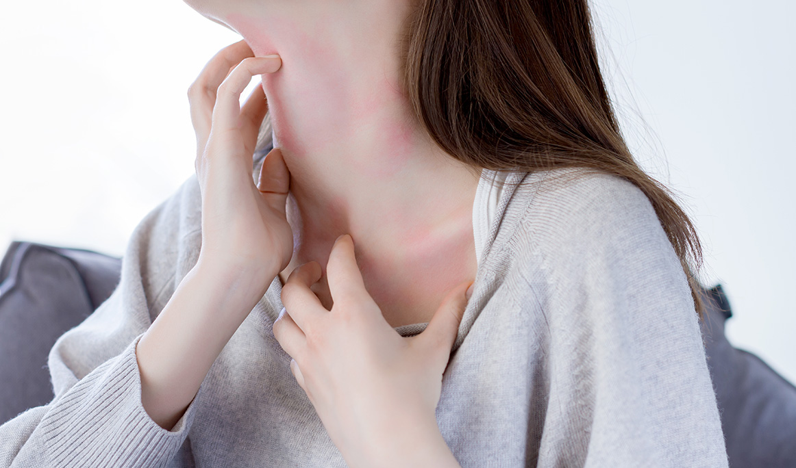 Cómo diferenciar dermatitis atópica y alergia - Vive tu piel